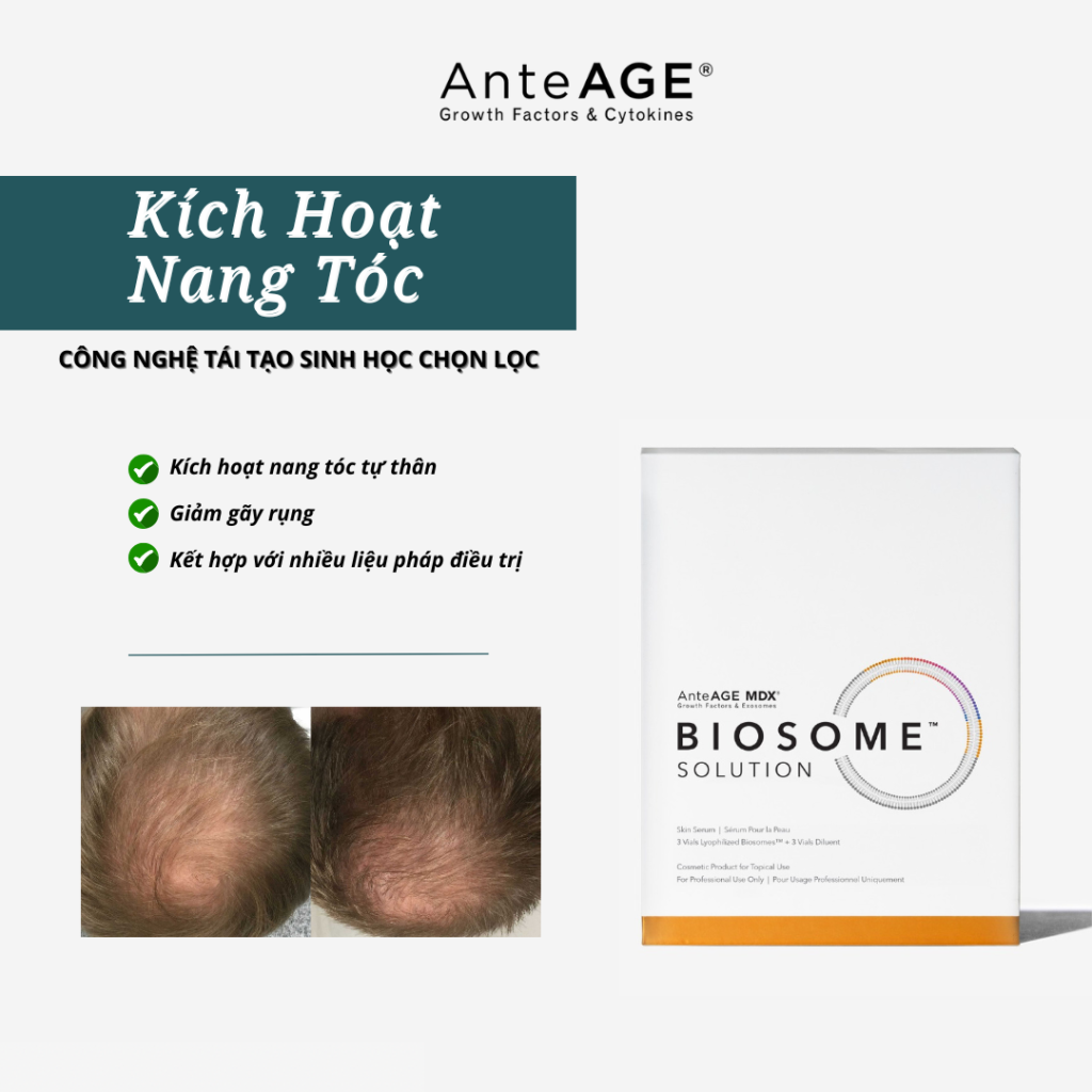 Kích Hoạt Nang Tóc Với Biosome