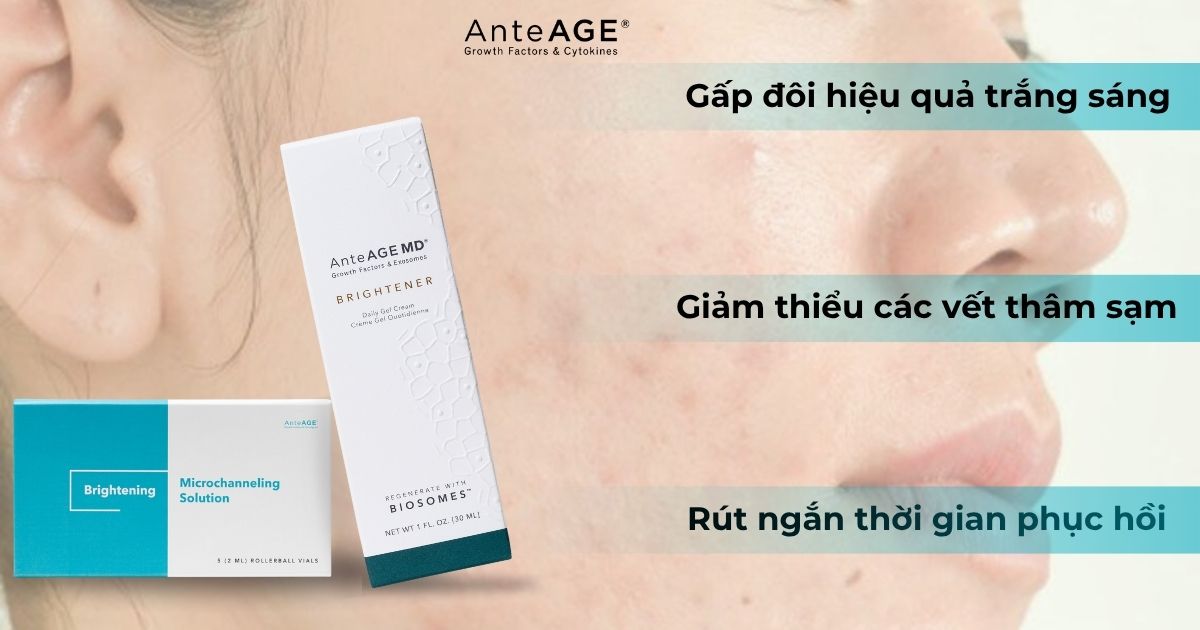 Tăng sắc tố sau mụn